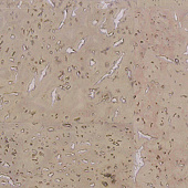 Пробковый пол Corkart Narrow Plank HDF CU3 185w CN B