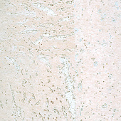 Пробковое настенное покрытие Corkart Classic PW3 386c WS-3.0